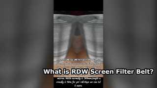 What is RDW Screen Filter Belt?
How RDW Screen Filter Belt Work?